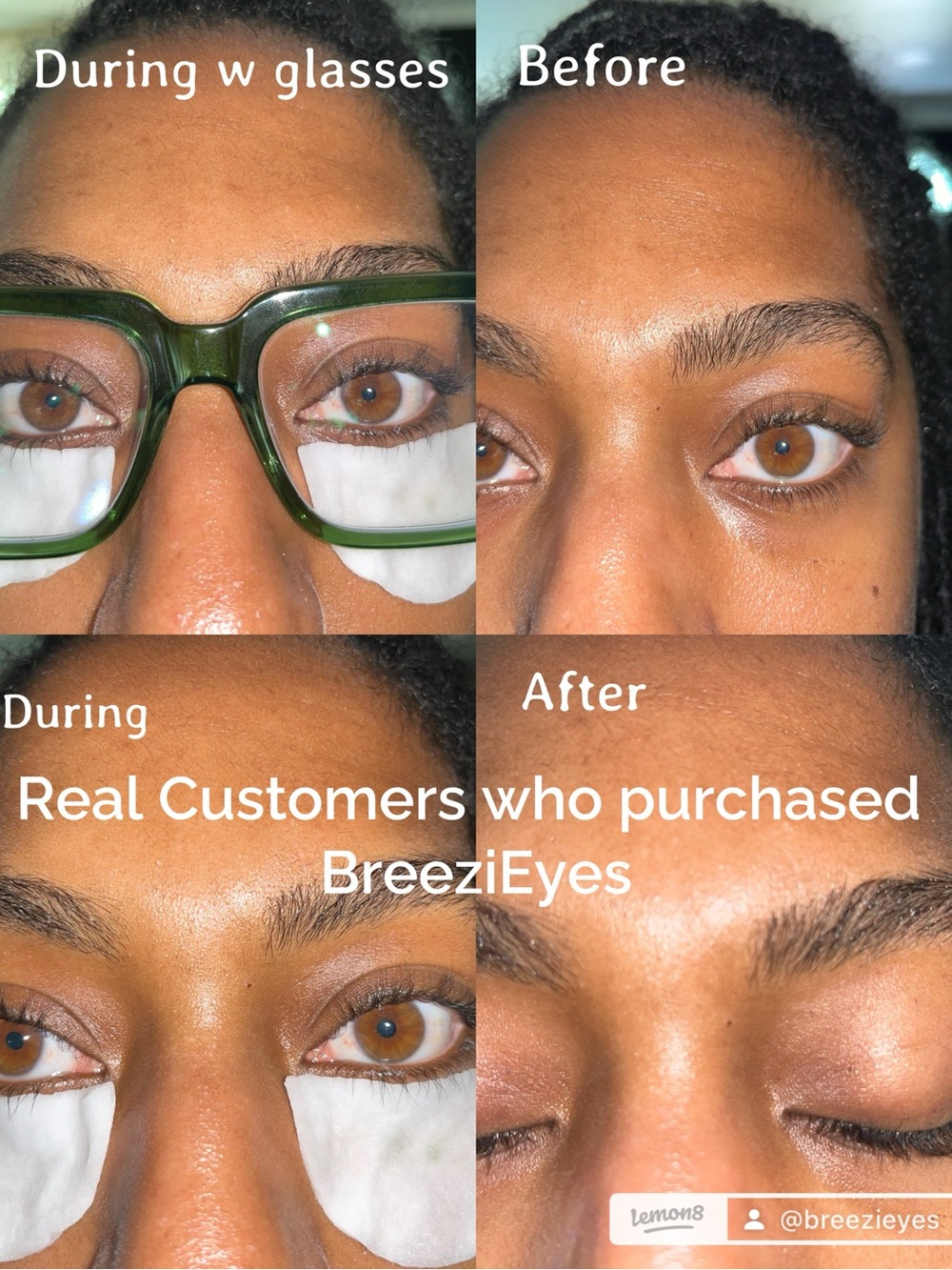 BreeziEyes™ Cooling Eye Pads 👁️❄️ Cooling Eye Pads - - Picture 8 of 9